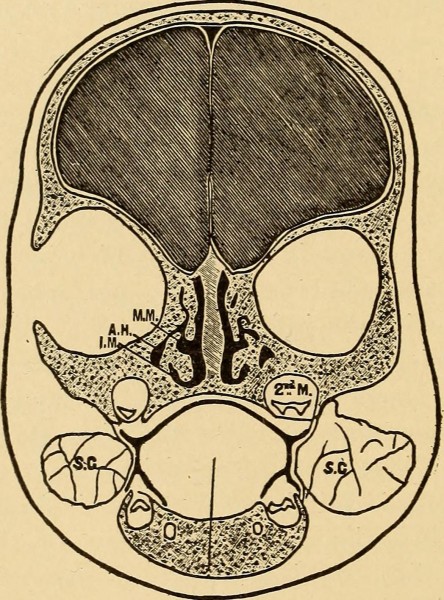 Image from page 291 of "The diseases of infancy and childhood" (1910)